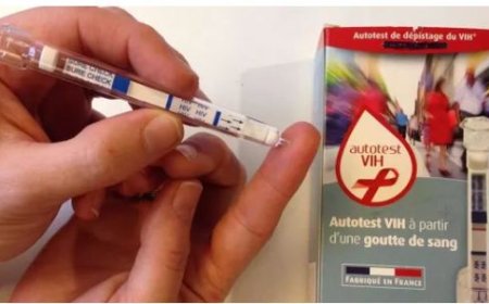 Ese birashoboka ko bitarenze 2030, SIDA izaba ari amateka?