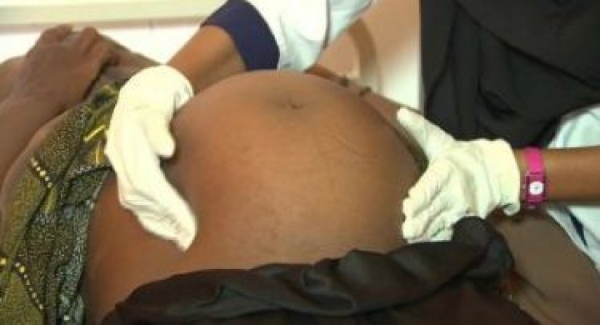 U Rwanda rurasabwa kongera umubare w’abaforomo nk’ibyarufasha kugabanya imfu z’ababyeyi n’abana muri 2030.