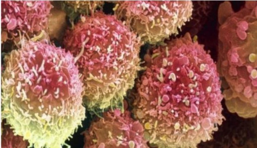 Benshi mu barwara bakanicwa na kanseri batabizi